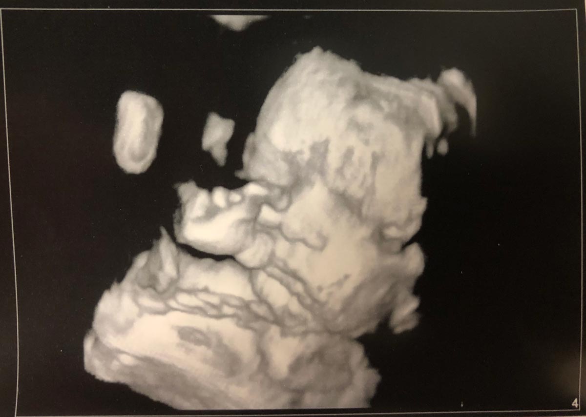 Ultrasound image of the kiddo at week 36